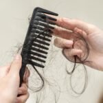 Hair Loss Remedies