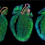 Cure for Heart – Supplications and Diet